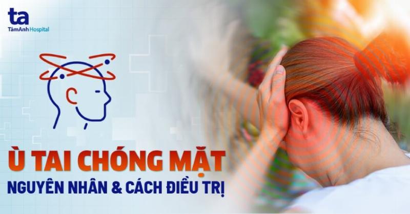 Hinh anh xe may dang dung tren chan chong giua thang bang